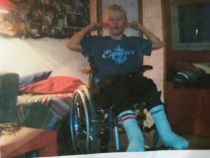 Kampuraleikkauksen jälkeen